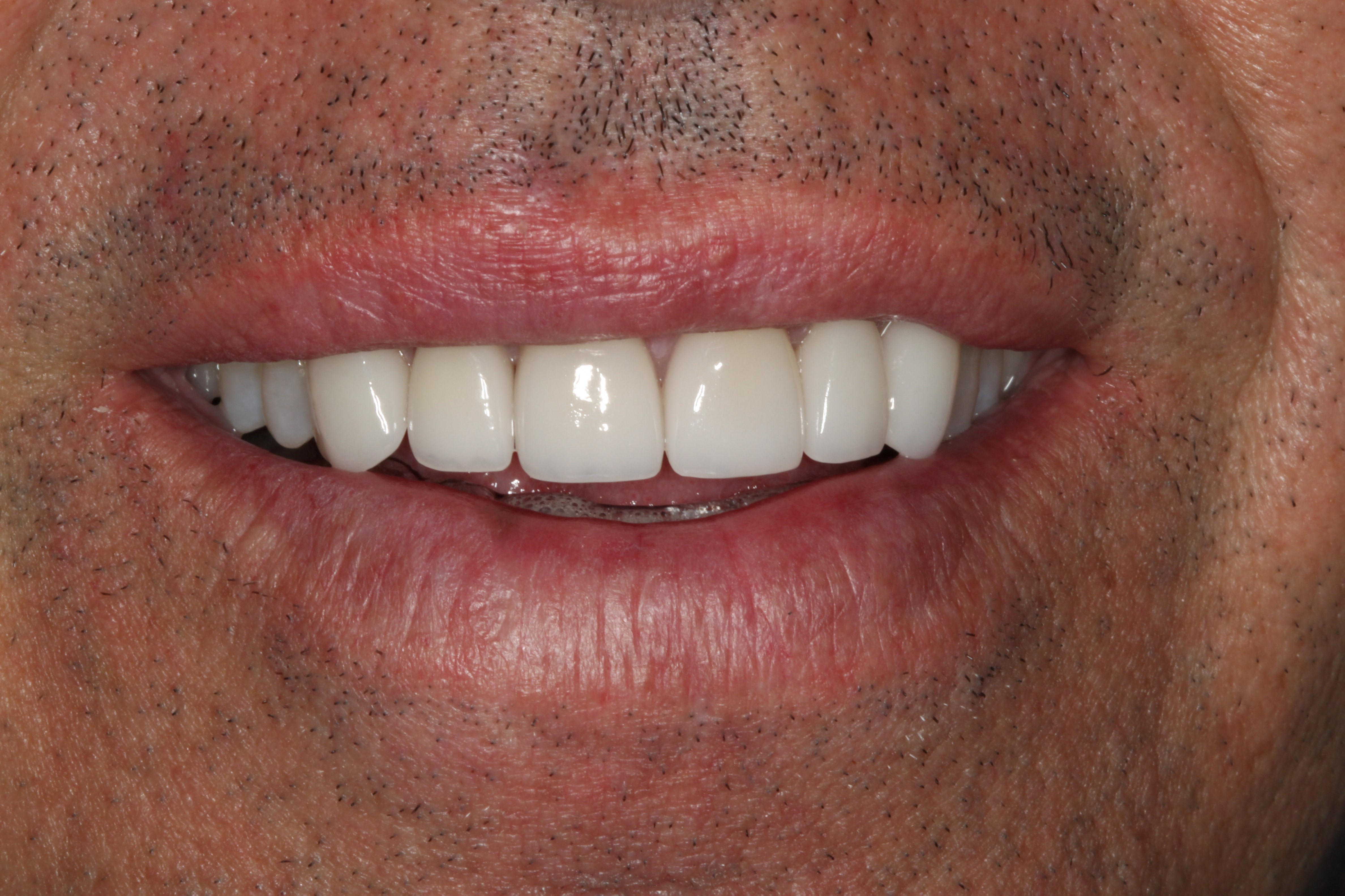 Smiles Gallery Tempe Family Dentistry