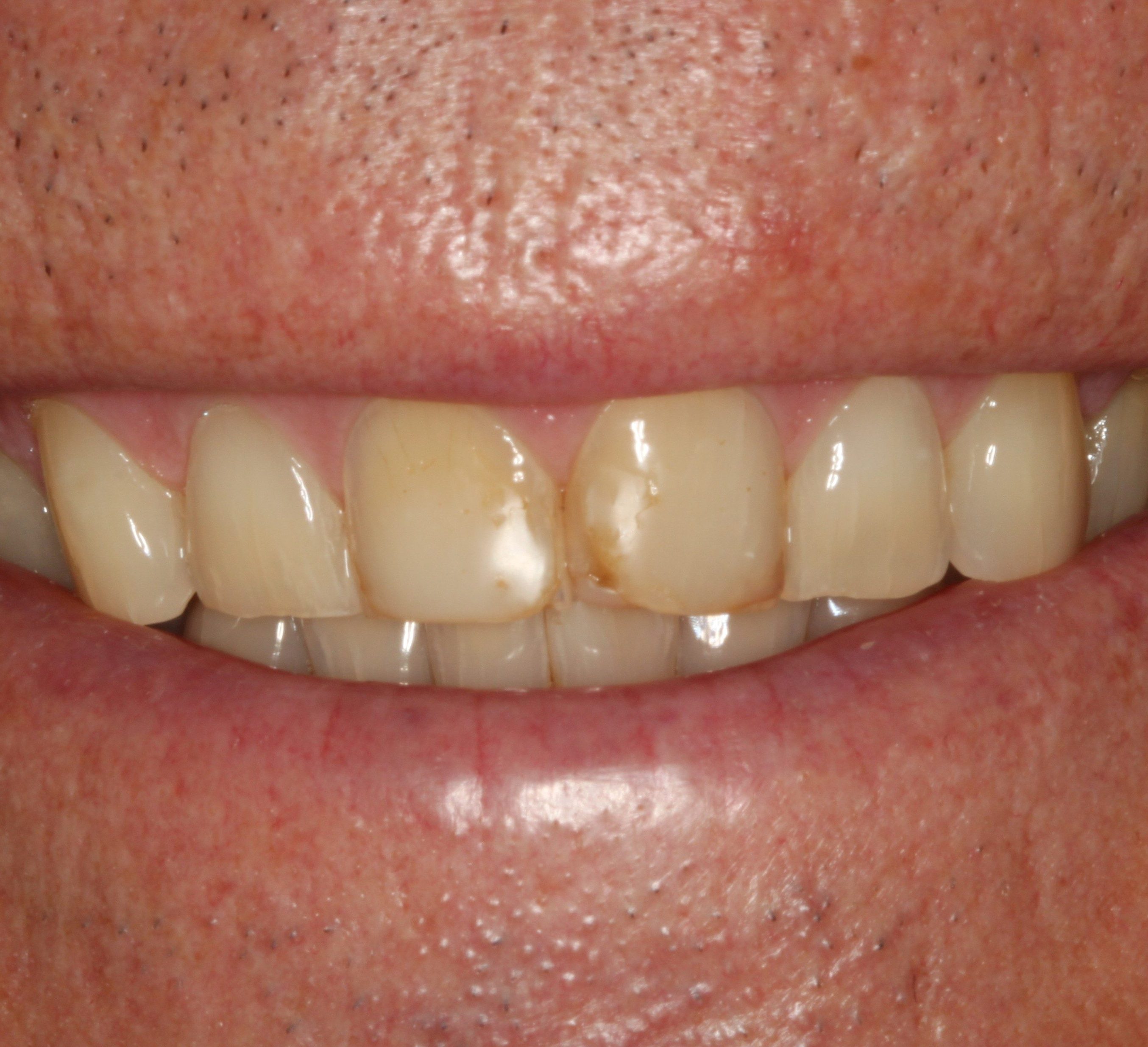 Smiles Gallery Tempe Family Dentistry