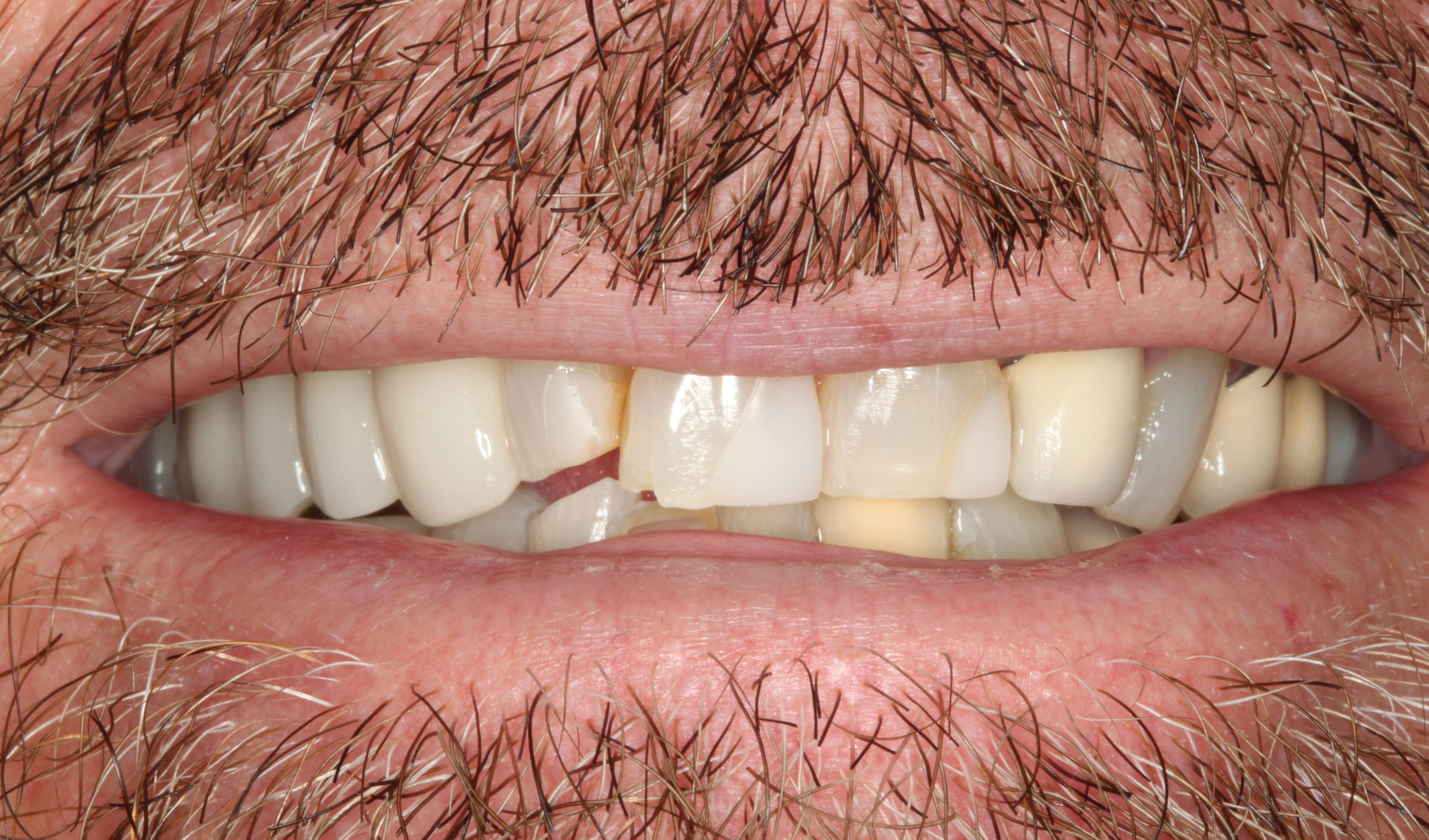 Smiles Gallery Tempe Family Dentistry