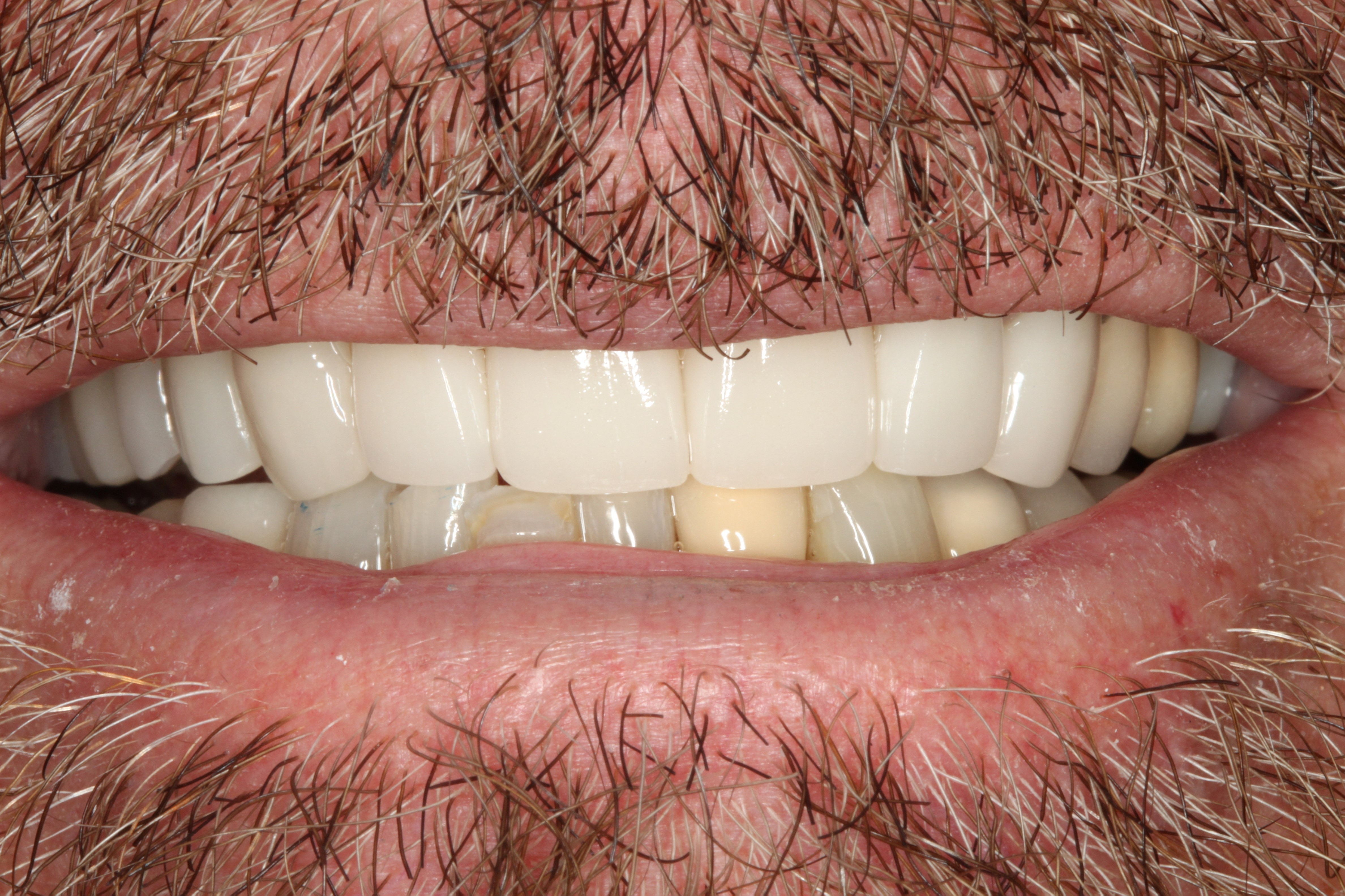 Smiles Gallery Tempe Family Dentistry