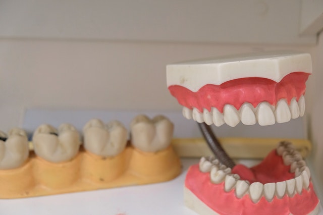 history of dentures