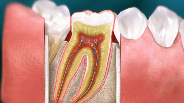 Root Canal Infection Warning Signs