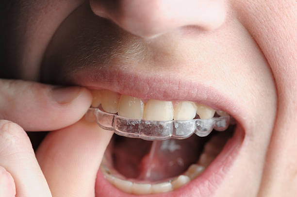 invisalign tempe family dentistry