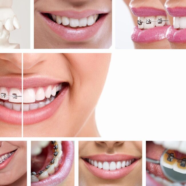 dental tempe arizona