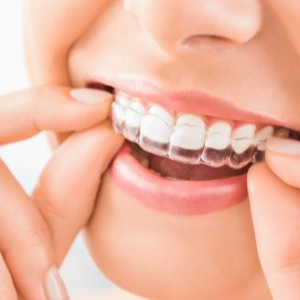 How Much Is Invisalign