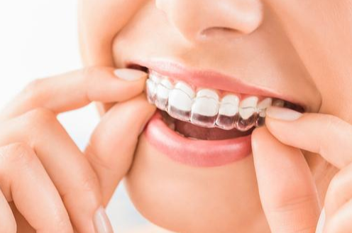 How Much Is Invisalign