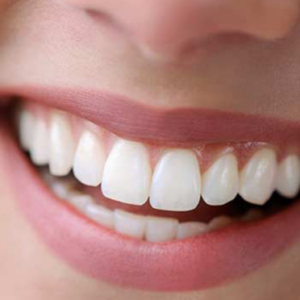 How Much Do Full Dental Implants Cost