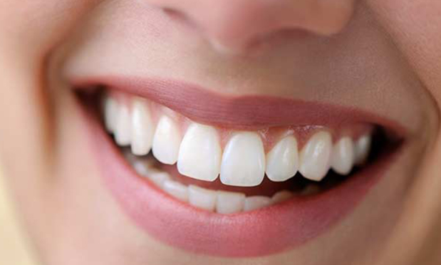 How Much Do Full Dental Implants Cost
