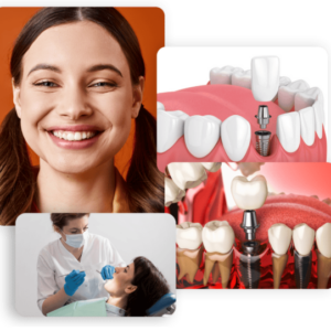 all on 4 dental implants cost
