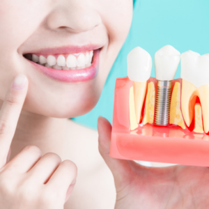 how much are dental implants